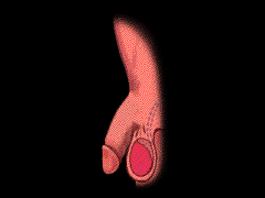 河池怎么才算勃起障碍 河池怎么才算勃起障碍