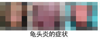 龟头炎会给男性带来哪些危害? 龟头炎会给男性带来哪些危害?