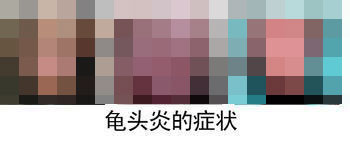 阴茎、龟头长有白色小疙瘩是怎么回事? 阴茎、龟头长有白色小疙瘩是怎么回事?